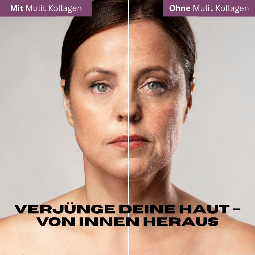 Multi Kollagen